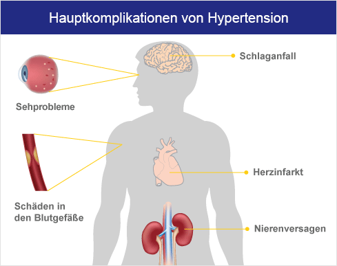 Bluthochdruck Medikamente Behandlung Auf Euroclinix Net