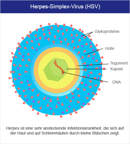 Herpes-Simplex-Virus