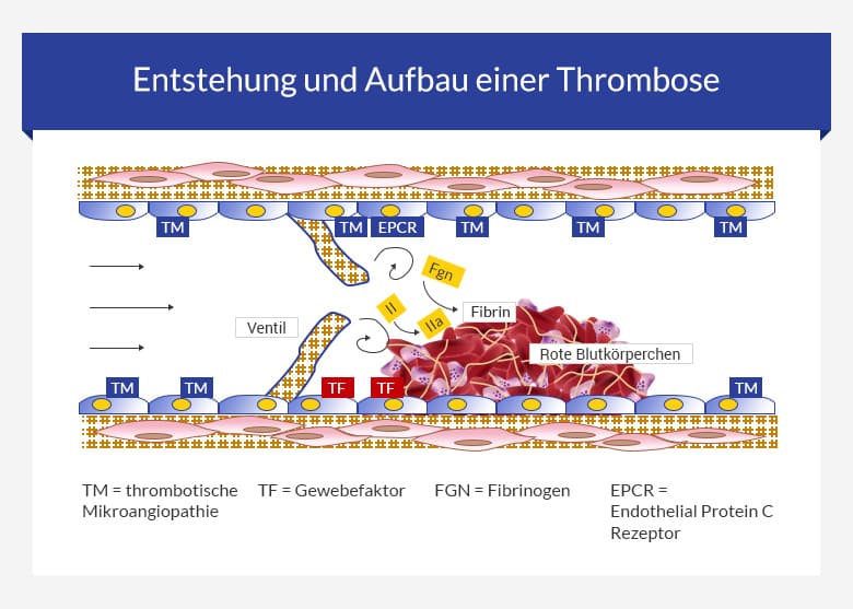 Thrombosen-Entstehung
