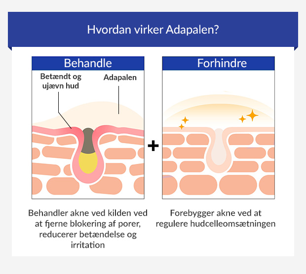 Infografik, der viser, hvordan adapalene behandler og forebygger akne