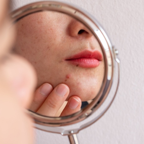 Understanding and managing side effects of the pill