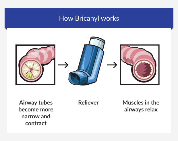 Infographic showing how Bricanyl works