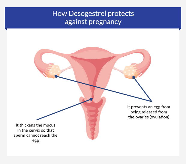 Graphic showing how Desogestrel protects against pregnancy