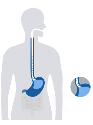 pantoprazole_human_image