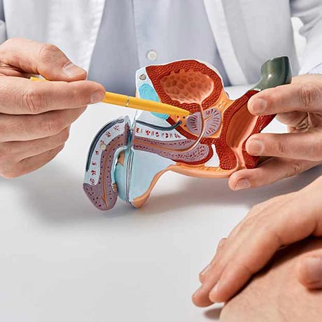 Kan prostata spille en rolle i impotens?