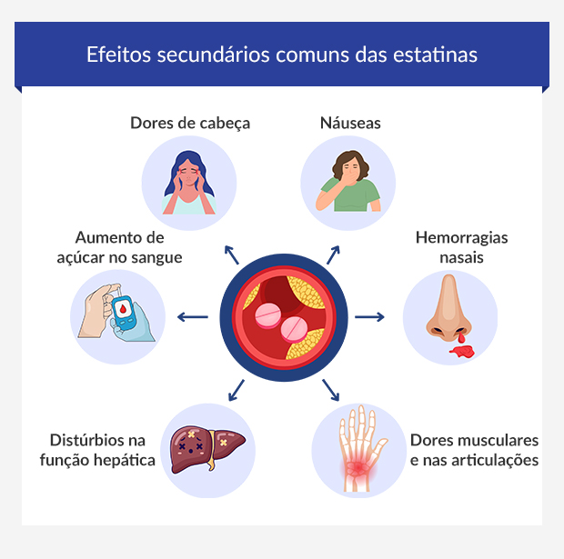Infográfico com 6 sintomas comuns provocados por estatinas.