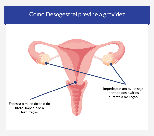 Gráfico a mostrar como Desogestrel impede a gravidez