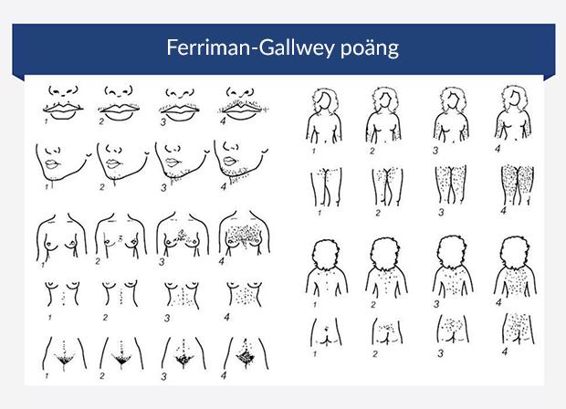 Grafik som illustrerar Ferriman-Gallwey-poäng