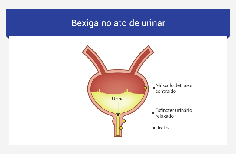 O Que é Conteudo Anecoico Homogeneo Na Bexiga