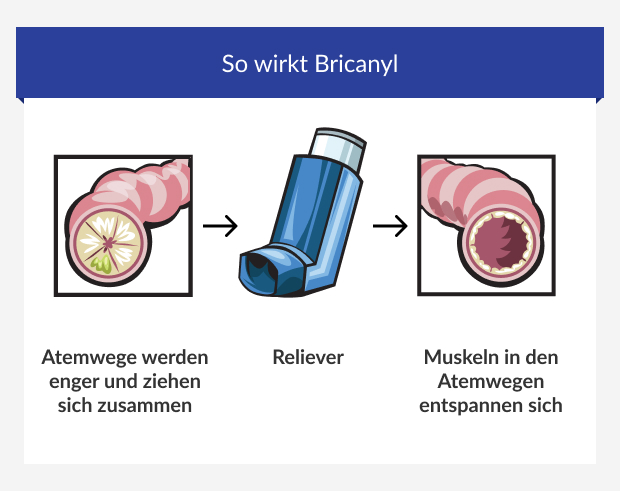 Infografik stellt die Wirkweise von Bricanyl dar