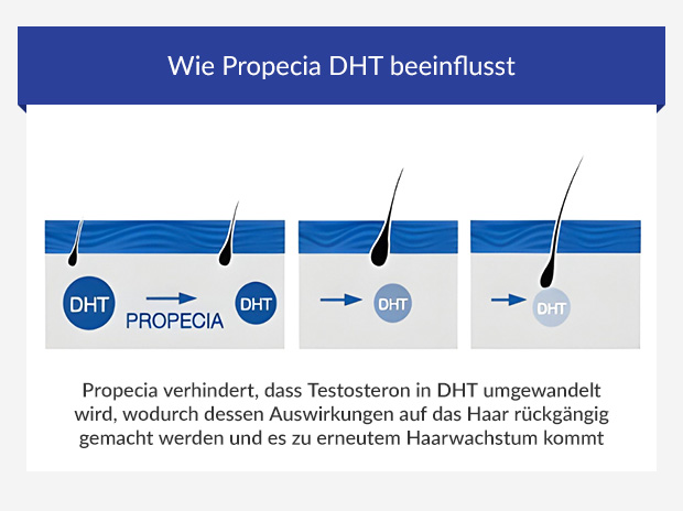 Grafik zeigt die Wirkung von Propecia auf DHT