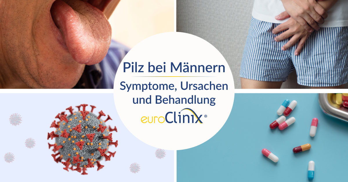 Pilz beim Mann Symptome, Ursachen und Behandlung