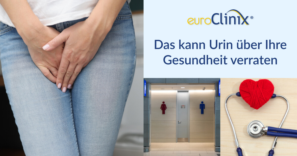 Das kann Urin über Ihre Gesundheit verraten