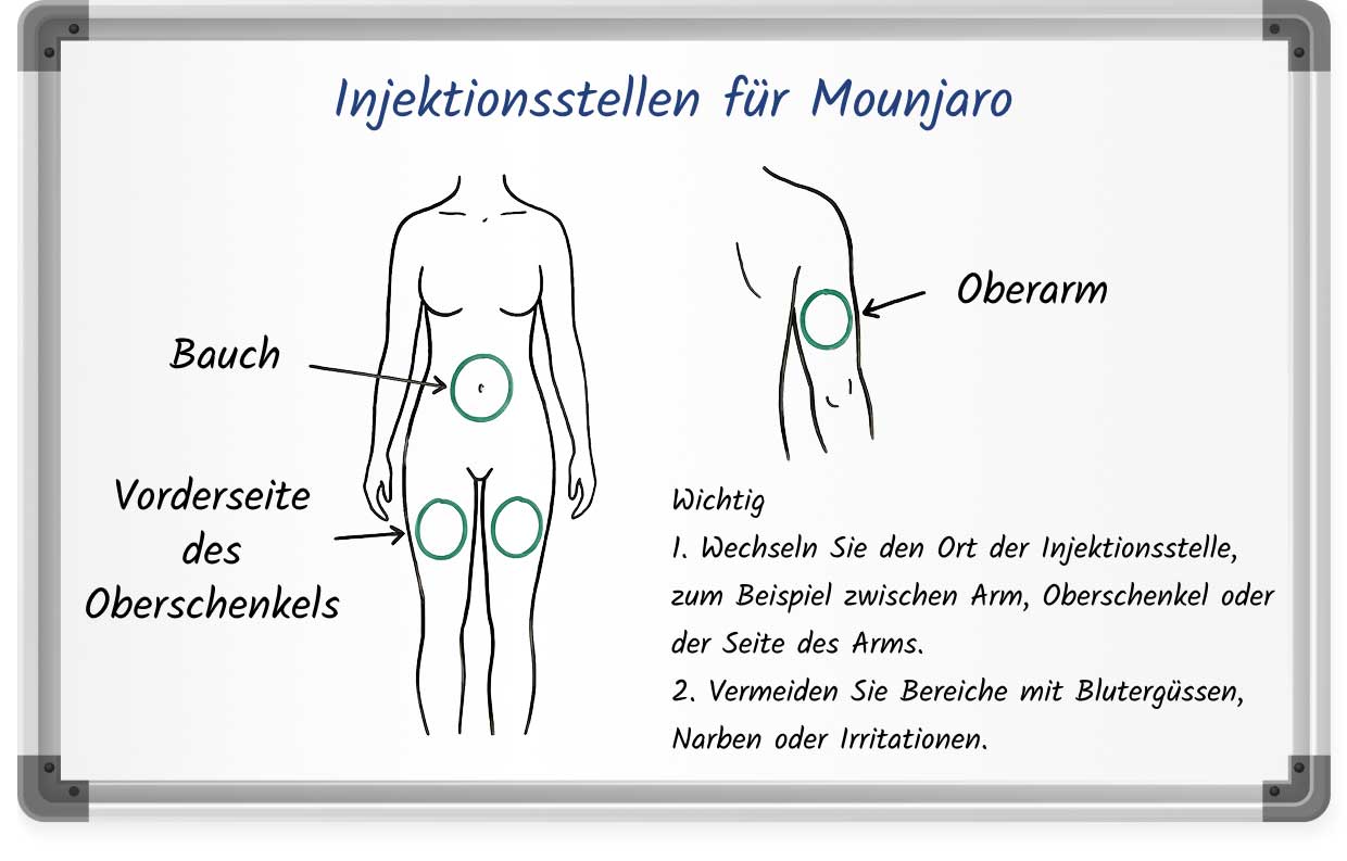 Diagramm zeigt die empfohlenen Mounjaro-Injektionsstellen am Bauch, an der Vorderseite des Oberschenkels und am Oberarm