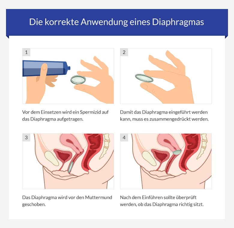 Diaphragma sicherheit
