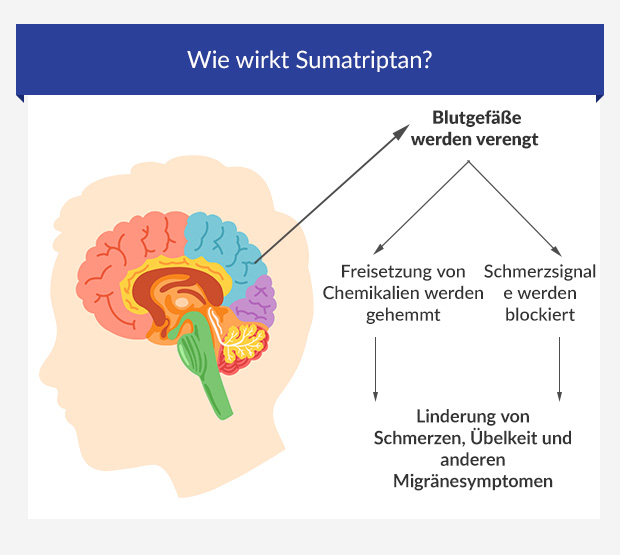 Grafik zeigt, wie Sumatriptan im Gehirn wirkt