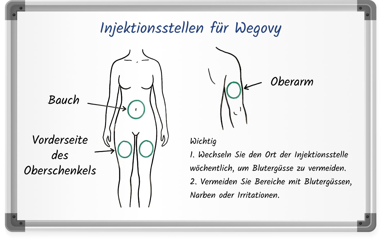 Diagramm zeigt die empfohlenen Wegovy-Injektionsstellen am Bauch, an der Vorderseite des Oberschenkels und am Oberarm