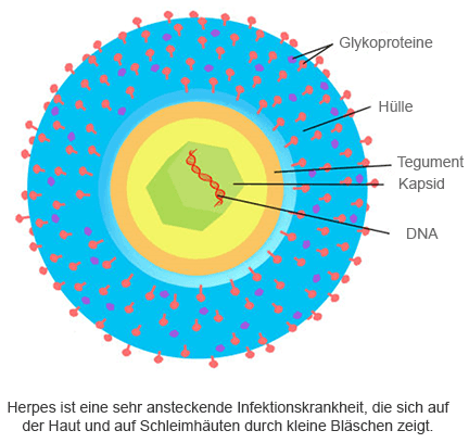 Herpes-Simplex-Virus
