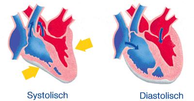 Hypertonie Bluthochdruck