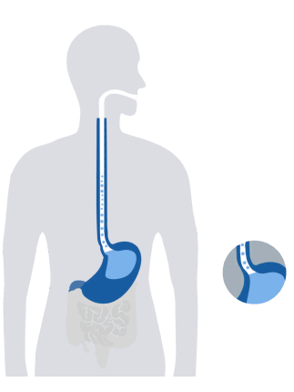 pantoprazole_human_image