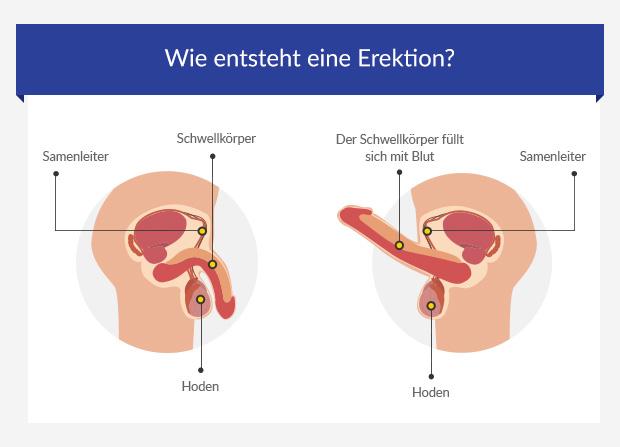 häufige ursachen der erektilen dysfunktion ed euroclinix