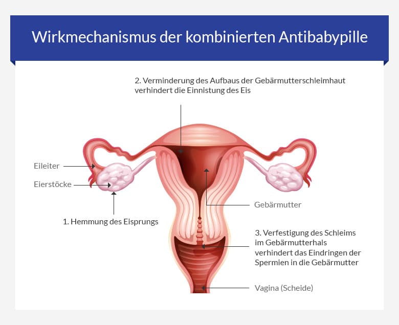Wirkungsweise Antibabypille Kombinationspräparat Gestagene Östrogen Levonorgestrel Minisiston 20 fem Wirkung Eisprung Gebärmutter Spermien