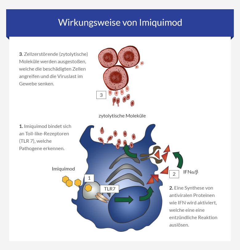 wo kann man imiquimod kaufen