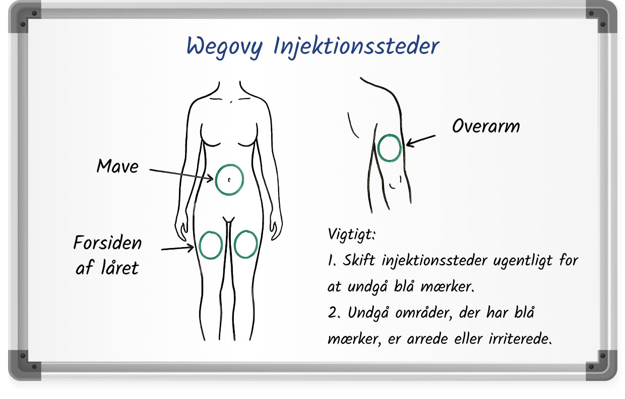 Diagram, der viser anbefalede Wegovy-injektionssteder på maven, forsiden af ​​låret og overarmen.