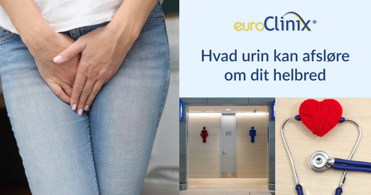 Hvad urin kan afsløre om dit helbred
