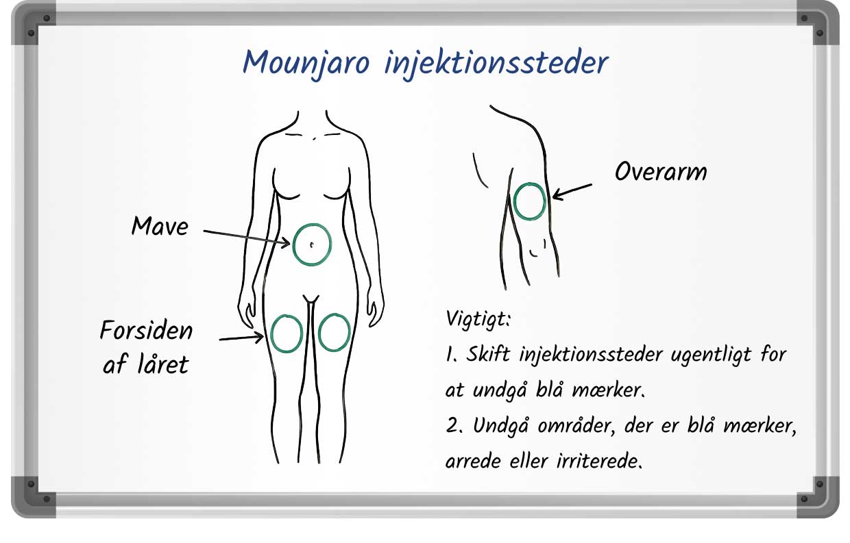 Diagram, der viser anbefalede Mounjaro-injektionssteder på maven, forsiden af ​​låret og overarmen.