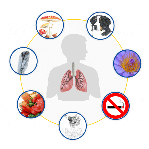 Постер астма. Факторы риска бронхиальной астмы. Аллергены бронхиальной астмы. Профилактика факторов риска бронхиальной астмы. Внутренние факторы риска бронхиальной астмы.