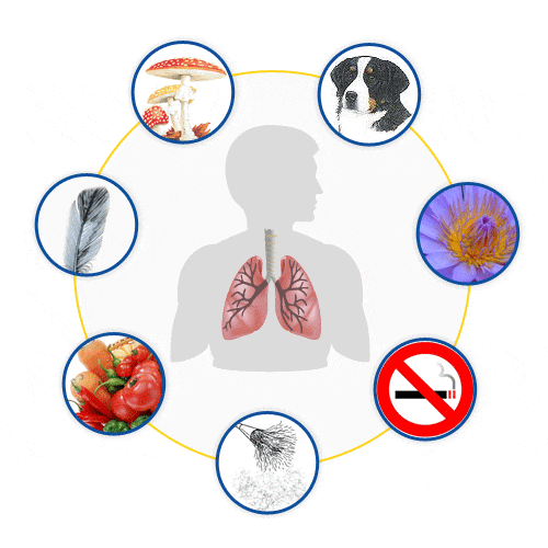 Триггеры астмы. Факторы риска бронхиальной астмы картинки. Аллергены бронхиальной астмы. Профилактика факторов риска бронхиальной астмы. Внутренние факторы риска бронхиальной астмы.