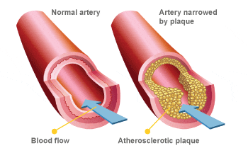 Does smoking cause erectile dysfunction Information and advice