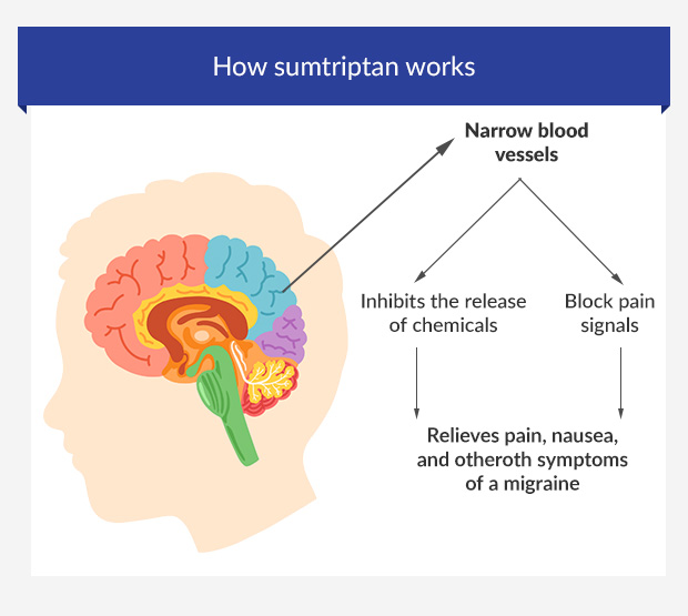 Graphic showing how sumatriptan works in the brain