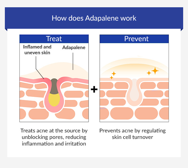 How does Adapalene work for body acne? How does Adapalene work for body acne?