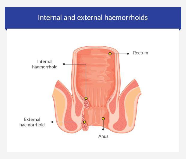 Benign lump on anus - Vet Help Direct