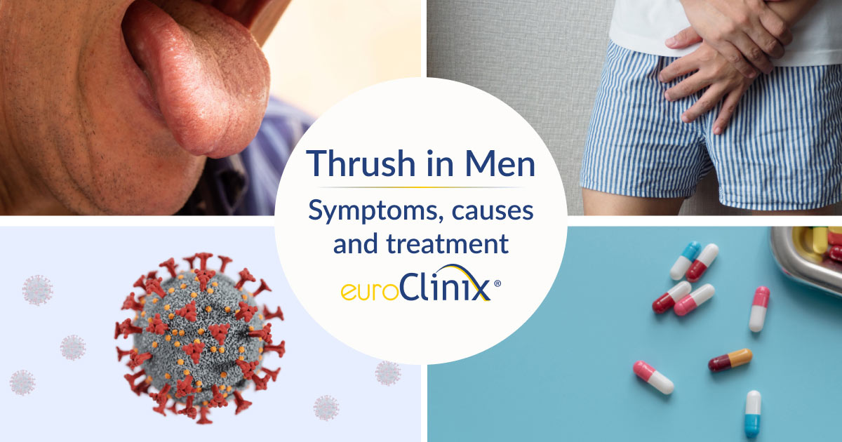 Symptoms, causes and treatment for thrush in men