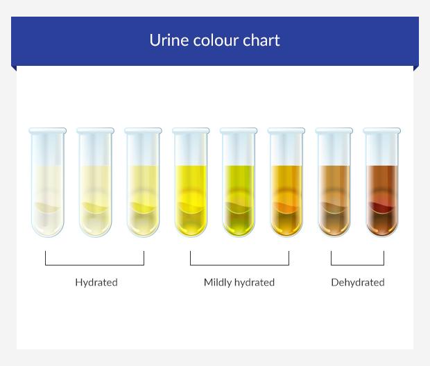 urine colour chart diabetes