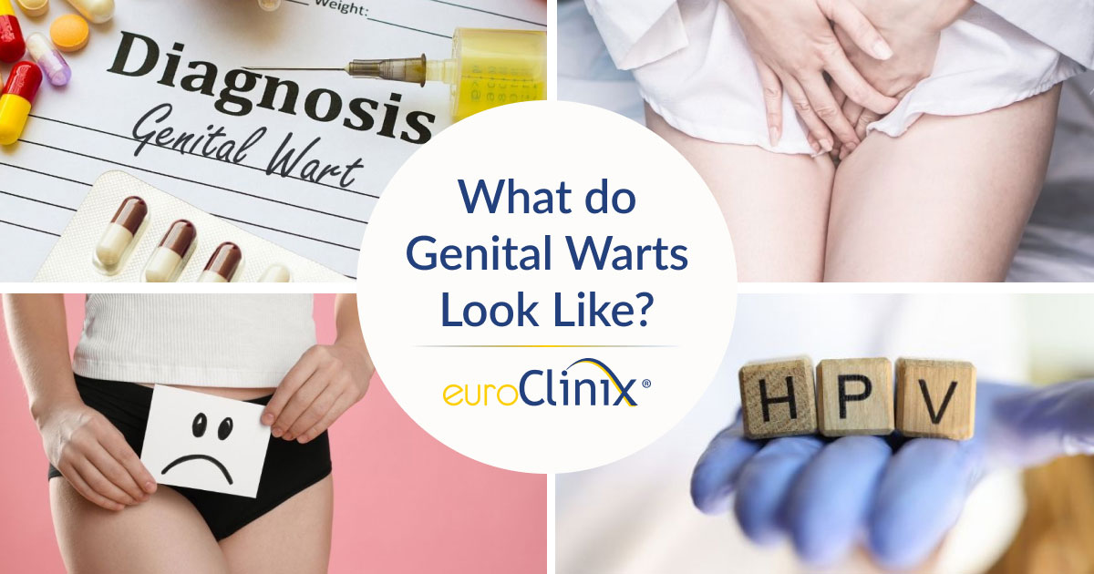 Collage image for an article titled: What do genital warts look like?