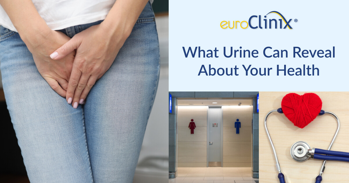 What urine can reveal about your health