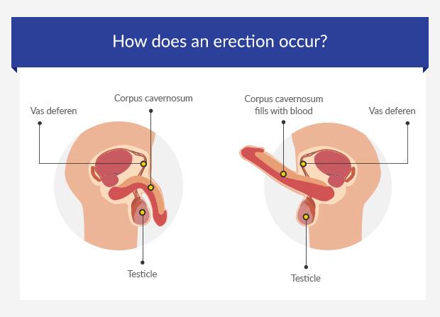 what causes an erection