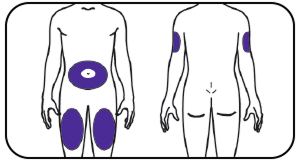  Diagram showing where you can inject Mounjaro