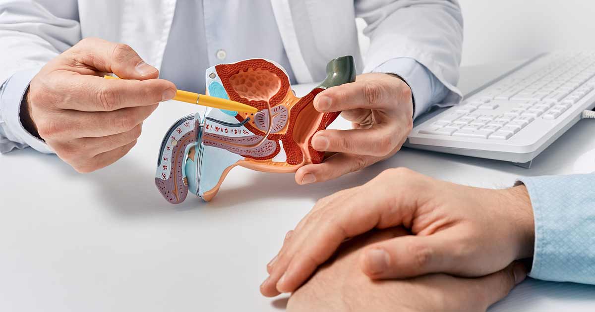 A doctor holding an anatomical model and pointing to the prostate