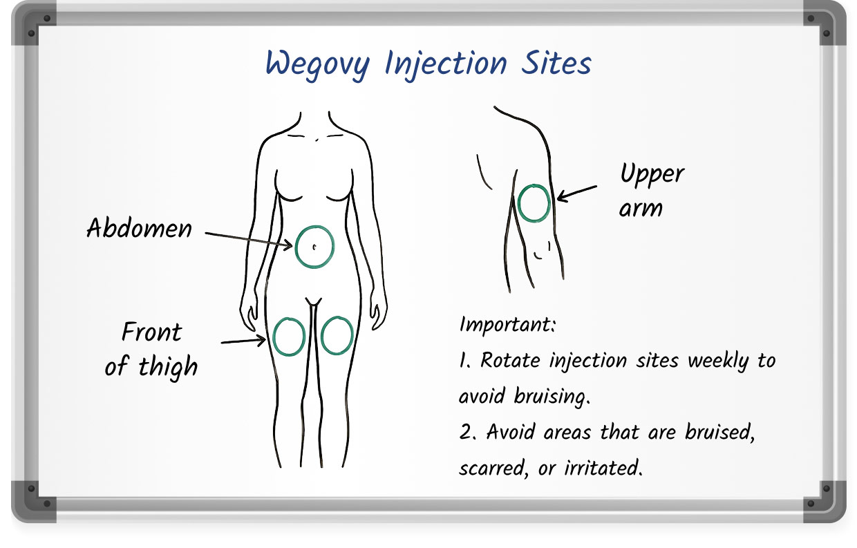 Diagram showing recommended Wegovy injection sites on the abdomen, front of the thigh, and upper arm