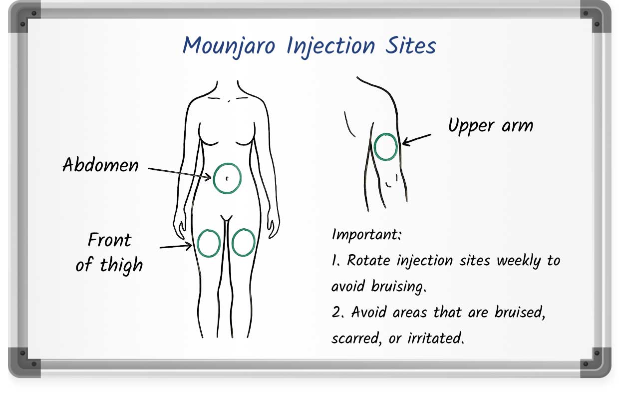 Diagram showing recommended Mounjaro injection sites on the abdomen, front of the thigh, and upper arm