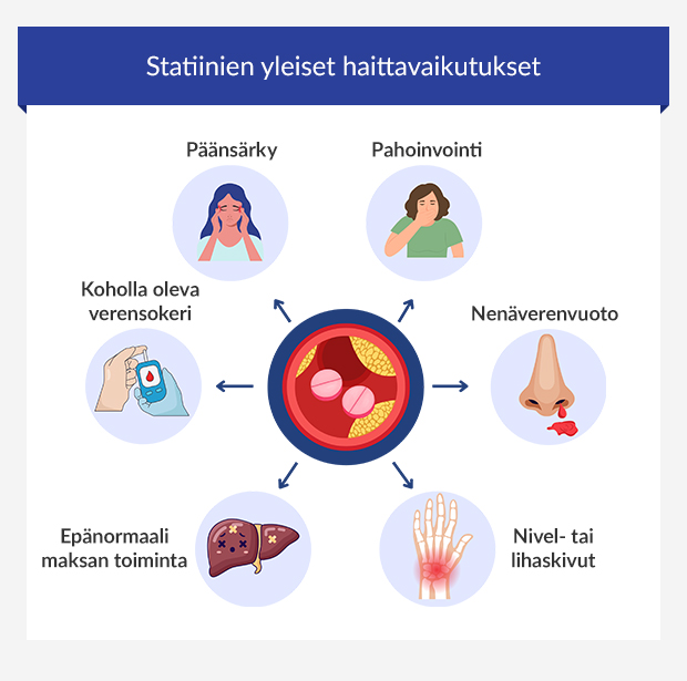 Infografiikka 6:sta yleisimmästä statiinien haittavaikutuksesta. 