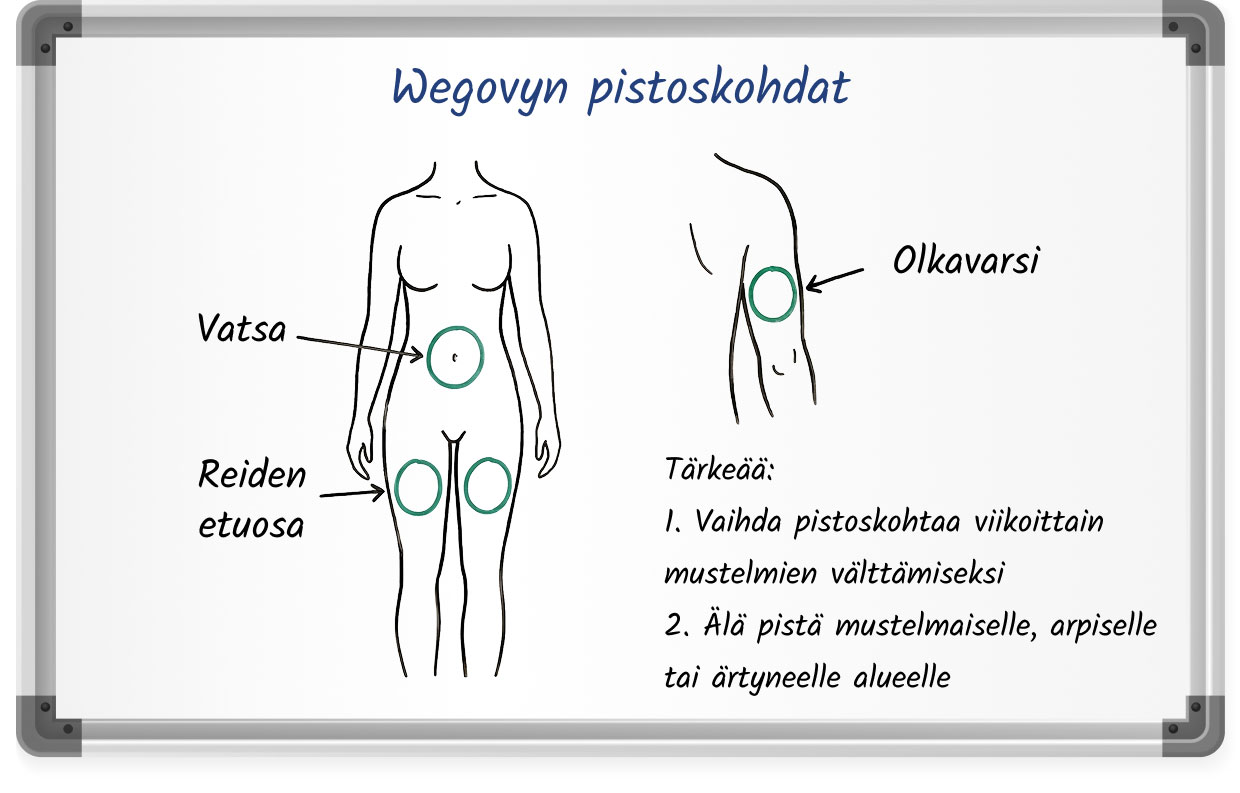 Kuvitus Wegovyn suositelluista pistoskohdista (vatsa, reisi, olkavarsi)