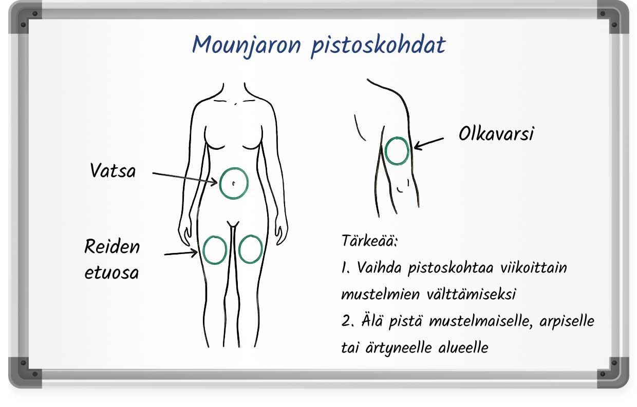 Kaavio Mounjaron suositelluista pistoskohdista: vatsa, reiden etuosa ja olkavarsi