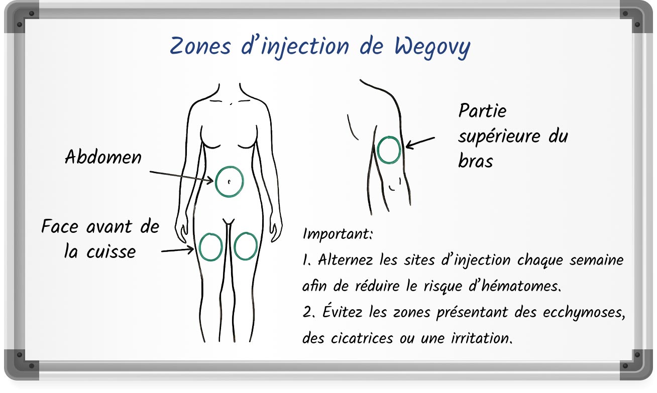 Schéma illustrant les sites d’injection recommandés de Mounjaro : abdomen, face avant de la cuisse et partie supérieure du bras