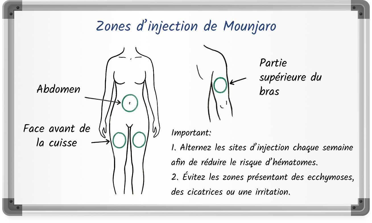 Schéma illustrant les sites d’injection recommandés de Mounjaro : abdomen, face avant de la cuisse et partie supérieure du bras